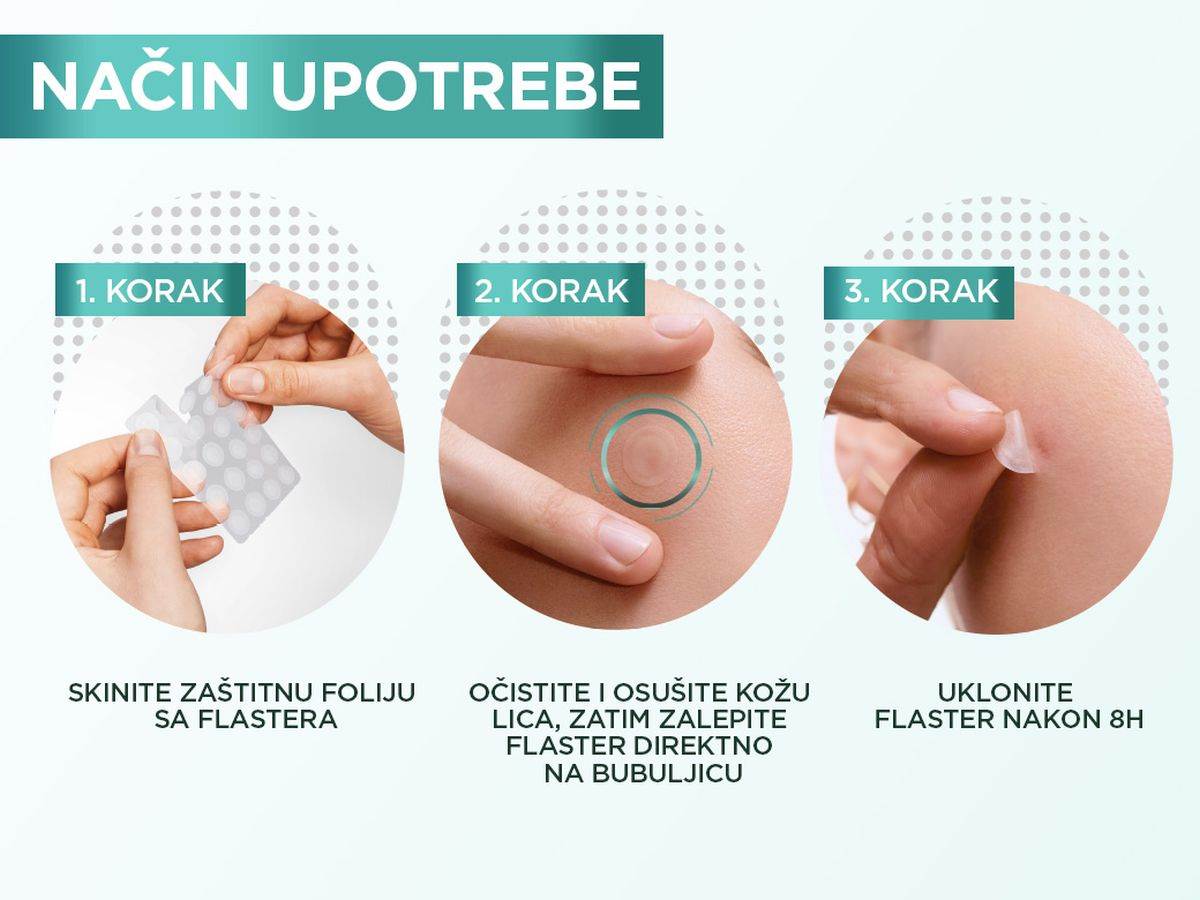 2 GAR-PimplePatch.jpg