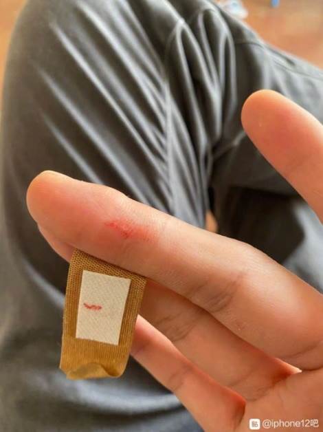 iphone 12 dizajn ostre ivice povrede korisnika