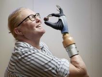 Karin bionička ruka