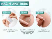 2 GAR-PimplePatch.jpg