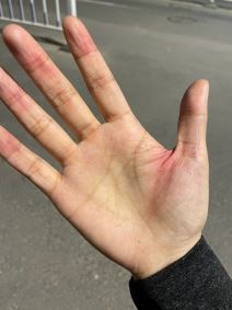 iphone 12 dizajn ostre ivice povrede korisnika