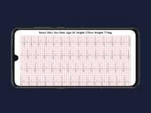 pametna majica fitnes ekg merenje