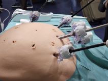 Bitrack hirurški robot