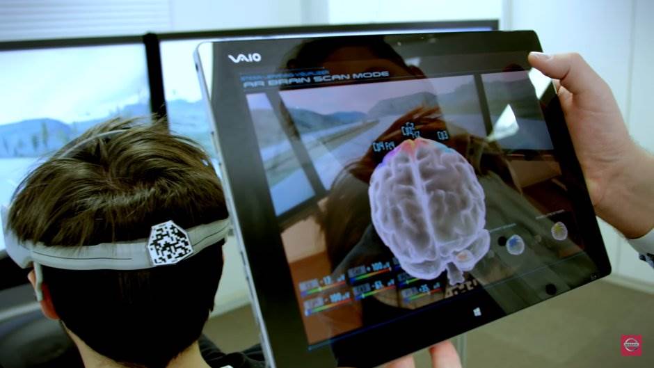 Ilon Mask, ugradnja čipova u mozak