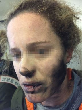 Slušalice zbog baterija eksplodirale u avionu