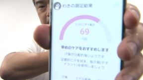 Znojenje prekomerno znojenje japanski izum