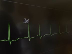 Heart Net mreža 1