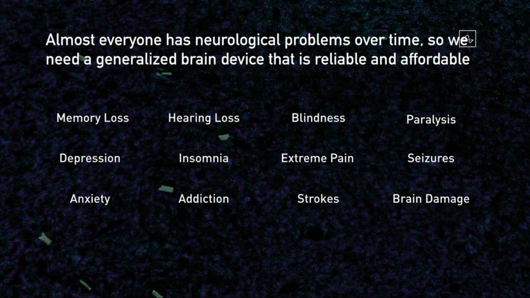 Cipovanje mozga Ilon Mask Elon Musk svinje 