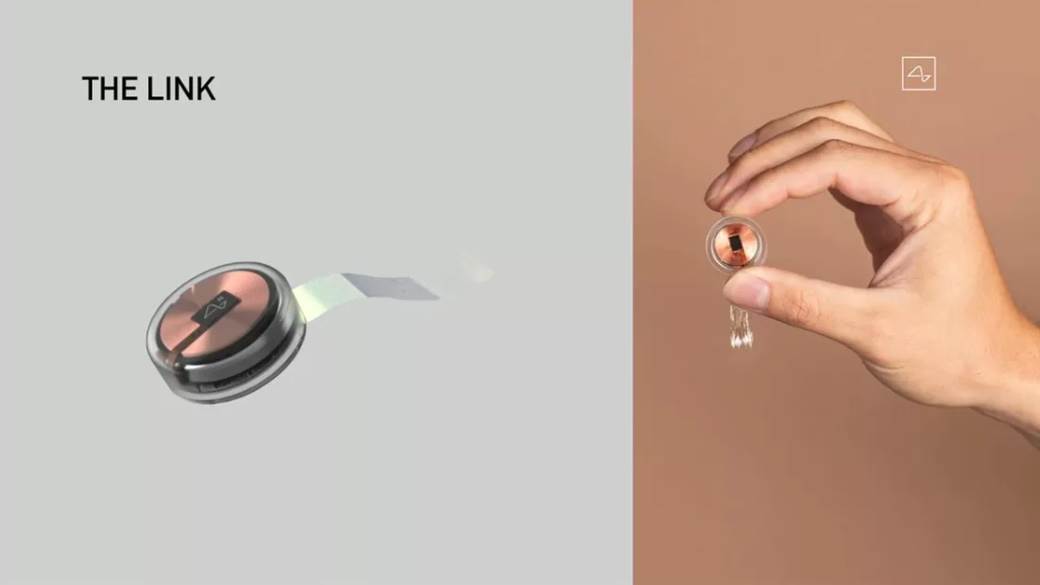 Cipovanje mozga Ilon Mask Elon Musk svinje 