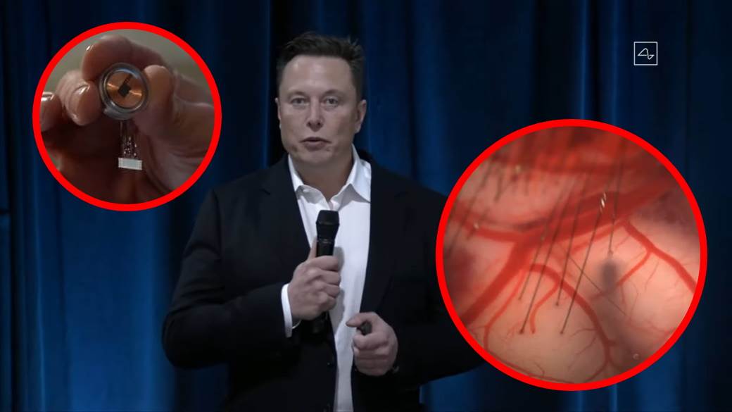 Cipovanje mozga Ilon Mask Elon Musk svinje 