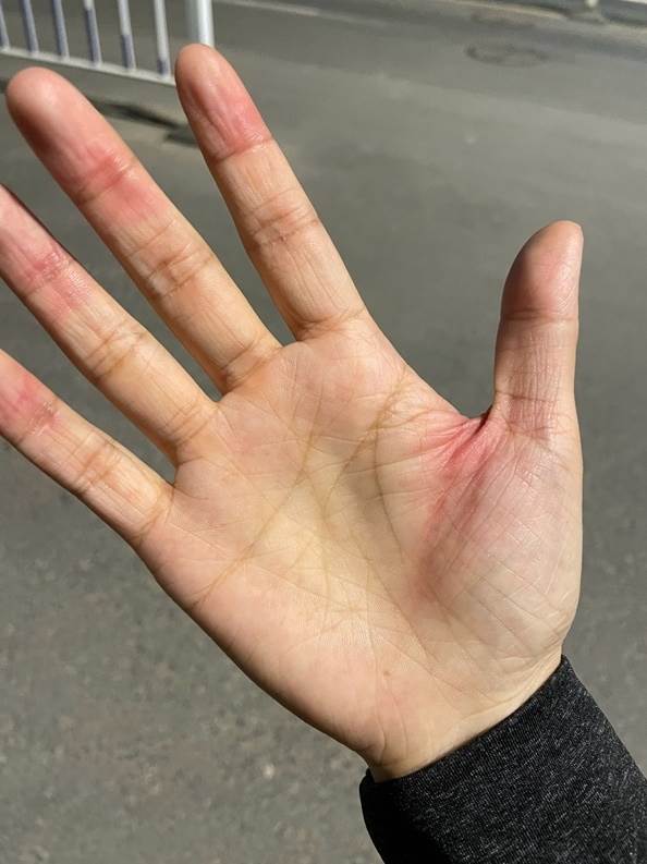 iphone 12 dizajn ostre ivice povrede korisnika