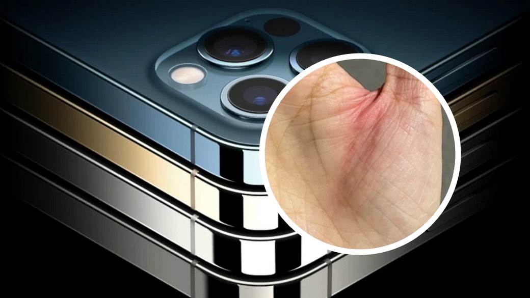 iphone 12 dizajn ostre ivice povrede korisnika