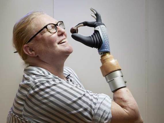 Karin bionička ruka