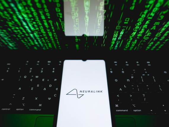 Neuralink _ Foto Profimedia.jpg