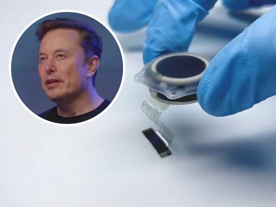 Neuralink masovna proizvodnja