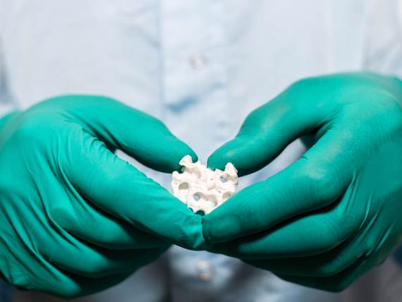 Bioštampana veštačka kost u rukama
