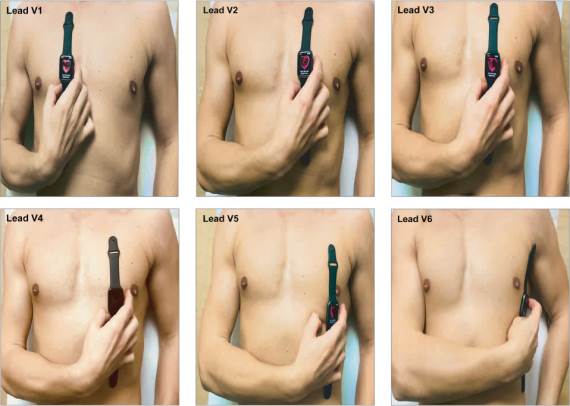 Otkrivanje srčanog udara