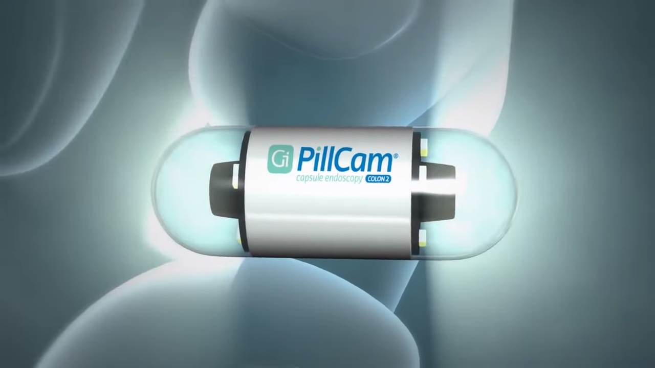 pilule sa kamerama rak creva zdravlje endoskopija 
