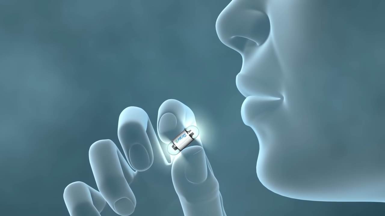 pilule sa kamerama rak creva zdravlje endoskopija 