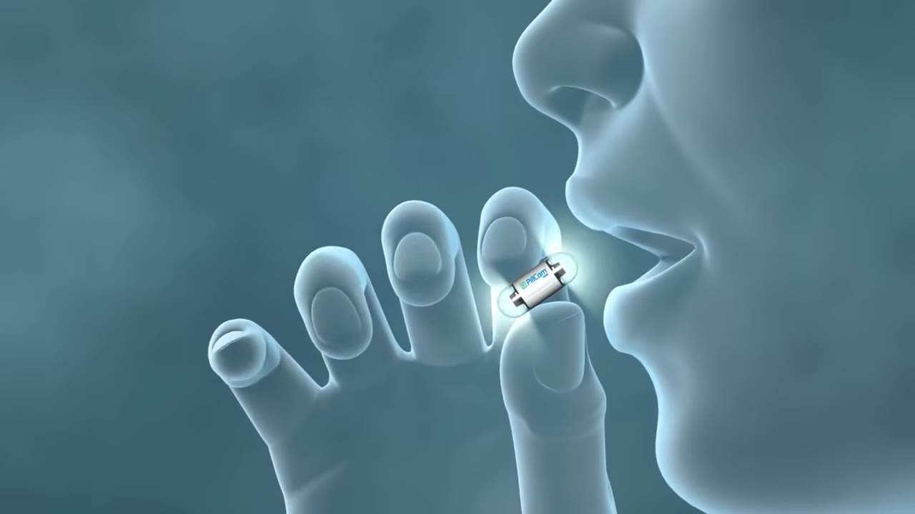 pilule sa kamerama rak creva zdravlje endoskopija 