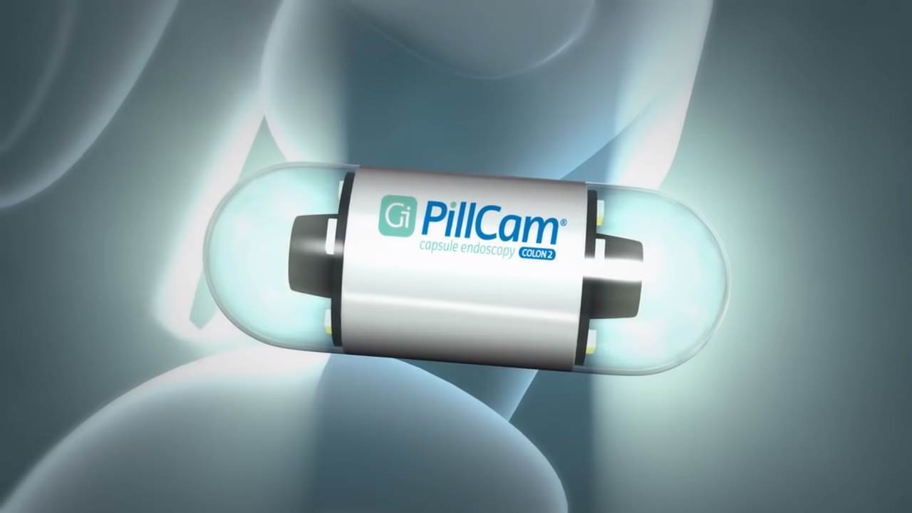 pilule sa kamerama rak creva zdravlje endoskopija 