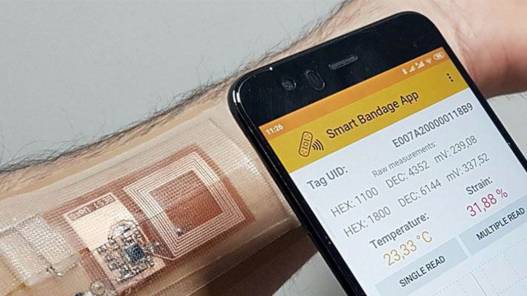 pametni flasteri brže zarastanje rana bolji oporavak aplikacija nfc čitanje podataka foto video