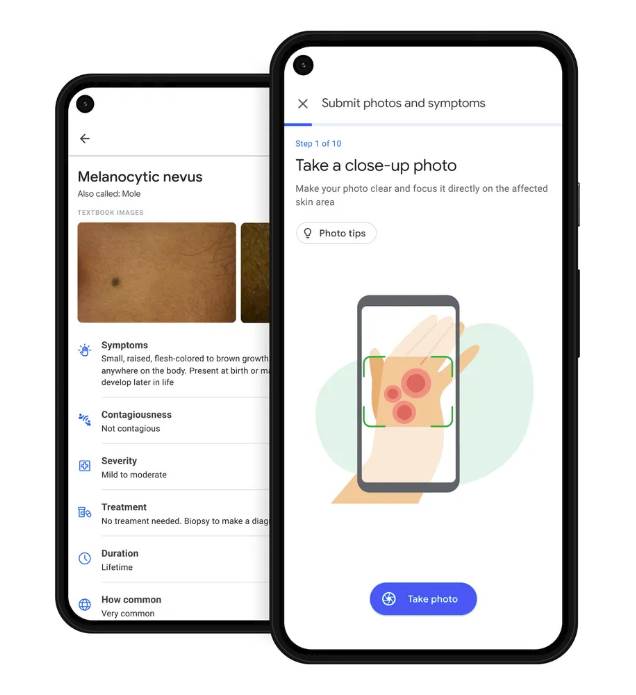 dermatology assist google aplikacija veštačka inteligencija