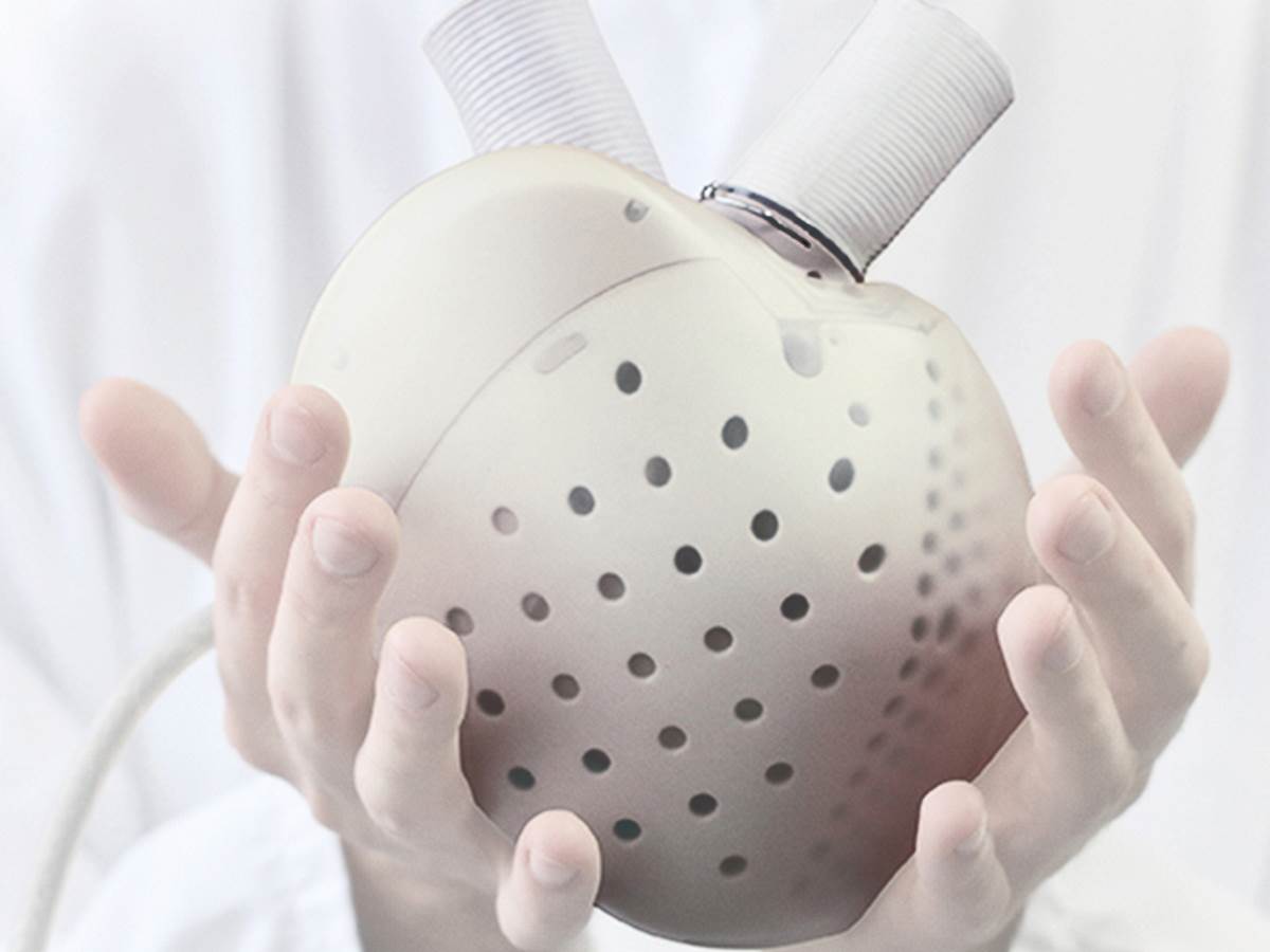 Veštačko srce Carmat cena 181.000 dolara spremno za ugradnju