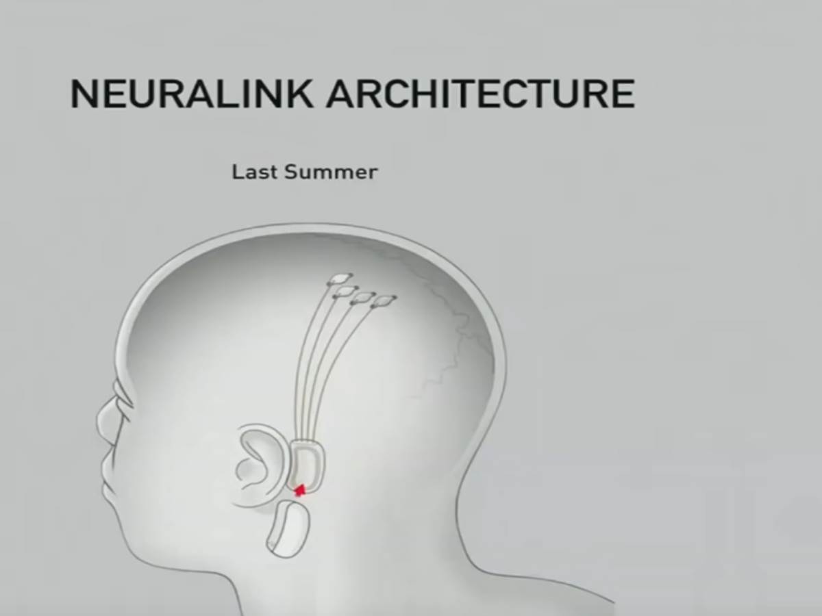 Neuralink.jpg