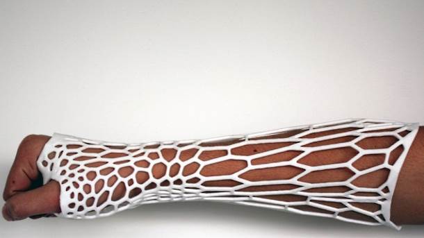 3D štampa ljudsko telo, 3D štampanje organa, Zamena organa 3D štampanim stvarima