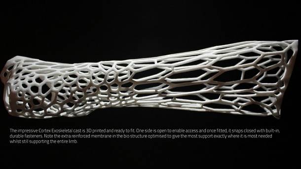 3D štampa ljudsko telo, 3D štampanje organa, Zamena organa 3D štampanim stvarima