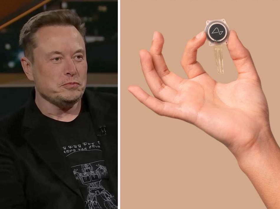 Ilon Mask i Neuralink implant