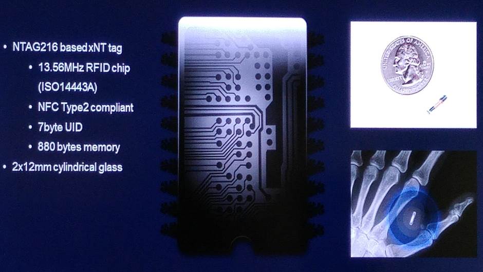 Cipovanje ljudi kako radi, koliko traje, koliko košta cipovanje ljudi