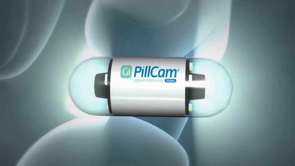 pilule sa kamerama rak creva zdravlje endoskopija 