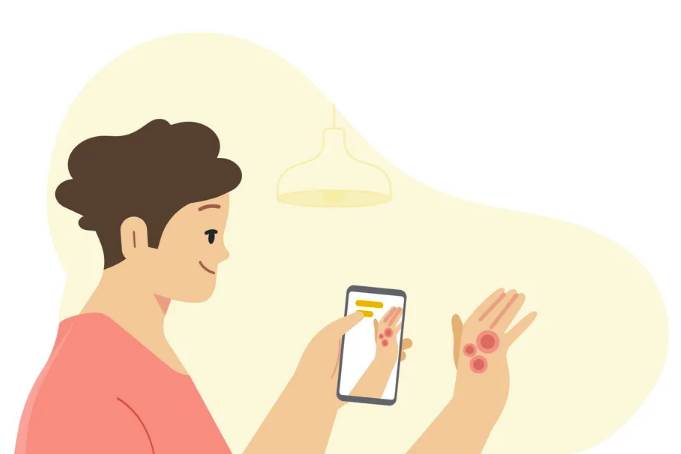 dermatology assist google aplikacija veštačka inteligencija