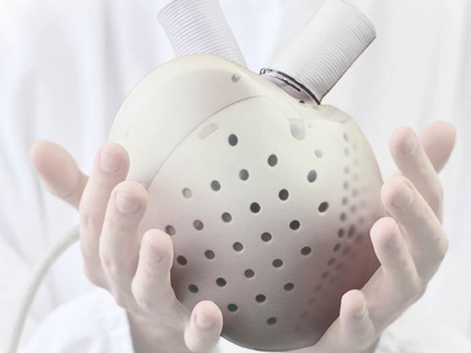 Veštačko srce Carmat cena 181.000 dolara spremno za ugradnju