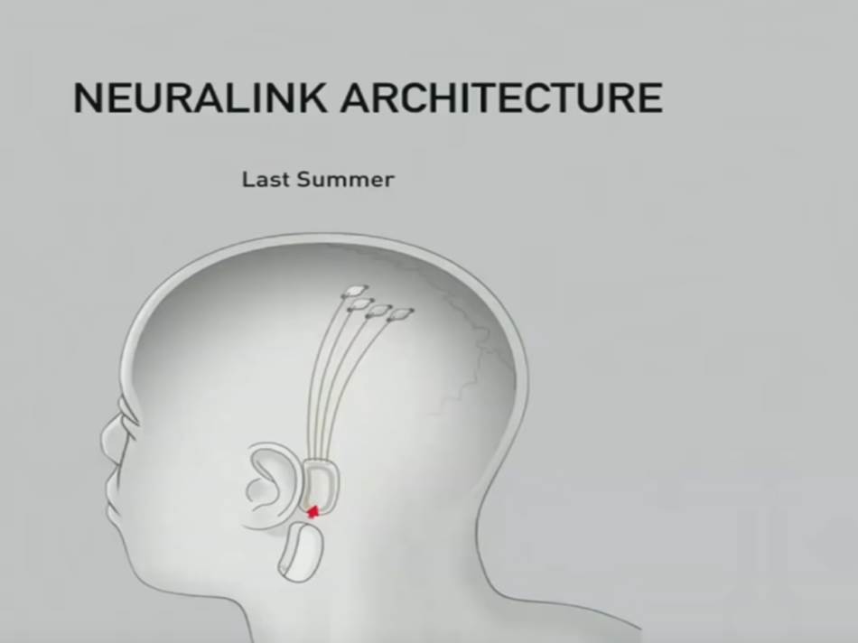 Neuralink.jpg