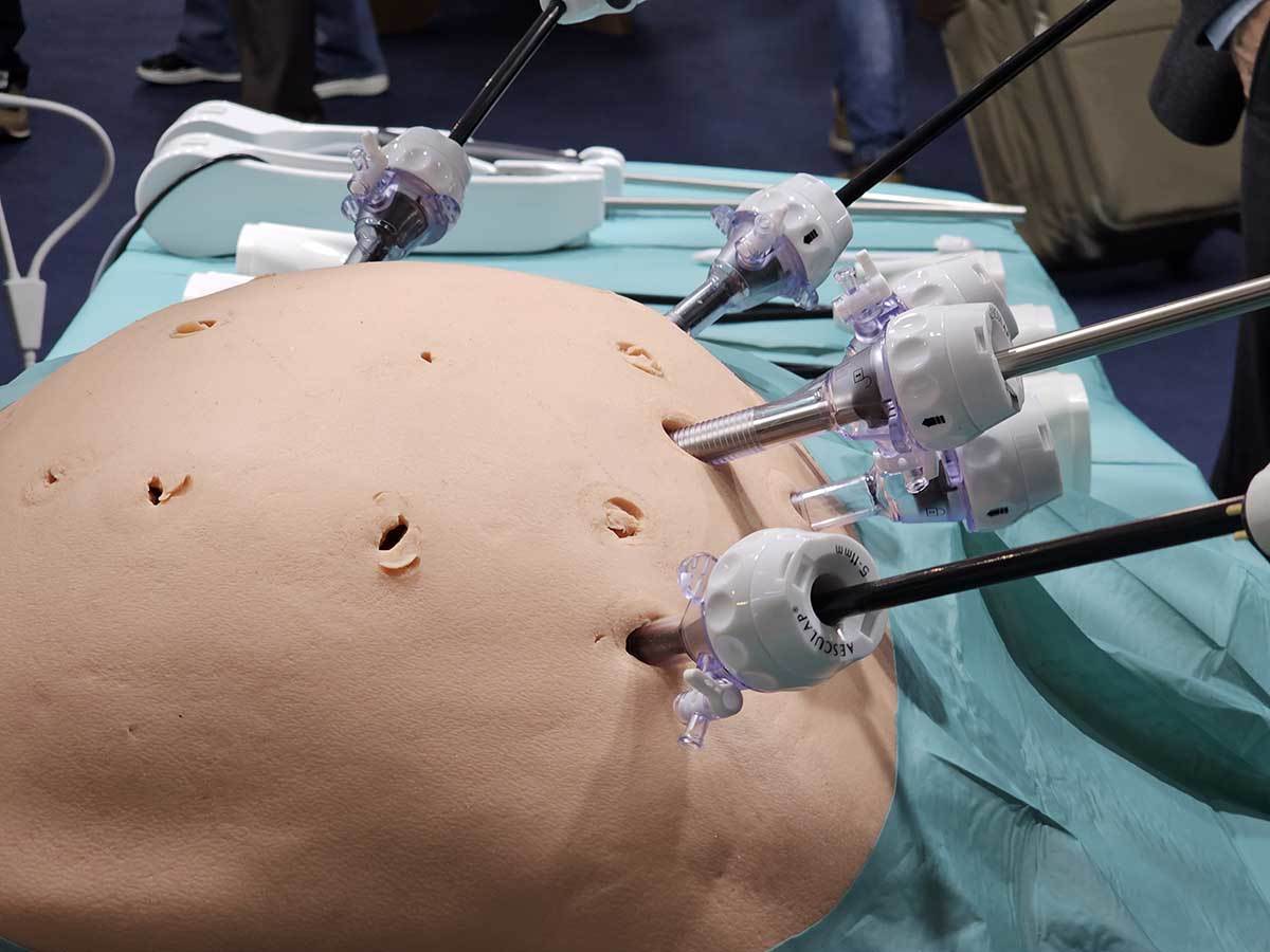 Bitrack hirurški robot 2.jpg